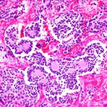 Popular story thumbnail