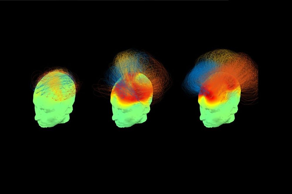 Image of heads with highlighted regions